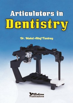 Articulators in Dentistry